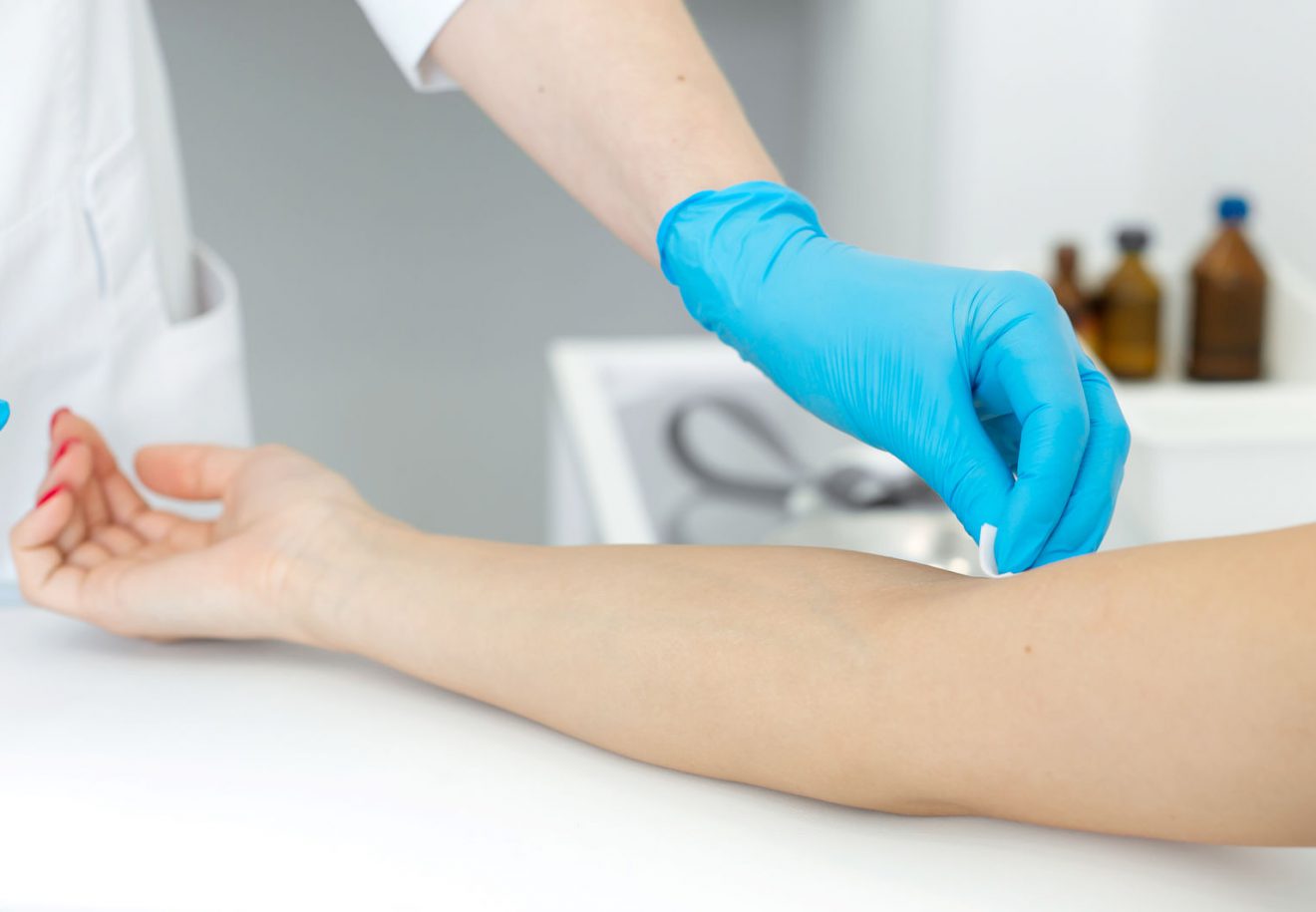 A nurse wipes a patient hand with a cotton pad soaked in an antiseptic. Blood sampling procedure