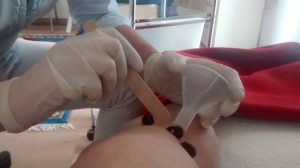 qualifizierte Blutegelbehandlung, Blutegel, Blutegeltherapie im Raum Deggendorf, Straubing, Passau, Landau, Landshut, Plattling, Osterhofen, Grafenau, Dingolfing